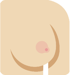 Breast Cancer - Background